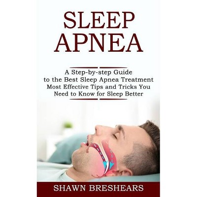 Sleep Apnea - by  Shawn Breshears (Paperback)