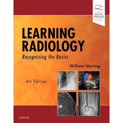  Learning Radiology - 4th Edition by  William Herring (Paperback) 