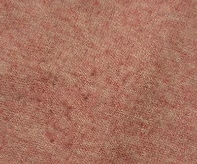 Guest review image 2 of 2, zoom in