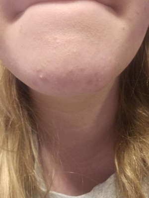 Guest review image 1 of 2, zoom in