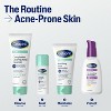 Cetaphil Gentle Clear Complexion Benzoyl Peroxide Acne Face Wash - 4.2 fl oz​ - 4 of 4