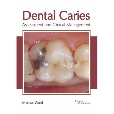 Dental Caries: Assessment and Clinical Management - by  Marcus Ward (Hardcover)