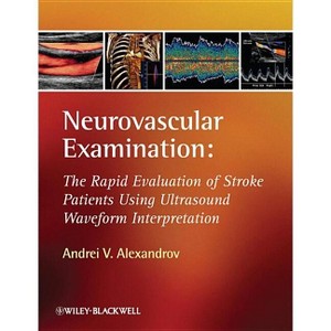Neurovascular Examination - by  Andrei V Alexandrov (Hardcover) - 1 of 1
