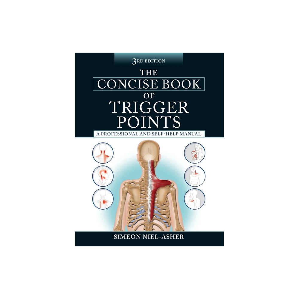 The Concise Book of Trigger Points, Third Edition - by Simeon Niel-Asher (Paperback)