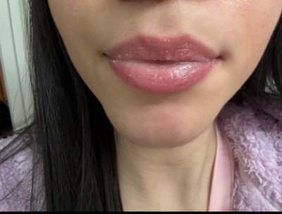 Guest review image 1 of 1, zoom in