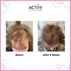 ACTiiV Hair Science Recover Shampoo & Conditioner for WOMEN Duo (16 oz XXL Pro Set) Active Thickening & Volumizing | Reduce Hair Loss | Fuller Hair - 2 of 3