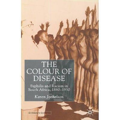 The Colour of Disease - (St Antony's) by  K Jochelson (Paperback)