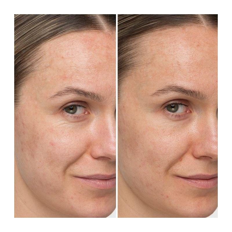 IT Cosmetics Confidence In A Cream Anti-Aging Face Moisturizer - Ulta Beauty, 3 of 11