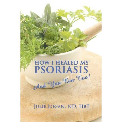 How I Healed My Psoriasis - by  Julie Julie Logan Nd Hbt (Paperback)