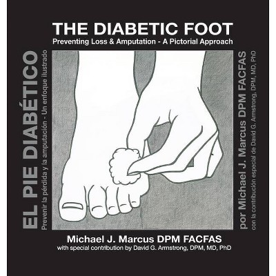 The Diabetic Foot - by  Michael J Marcus (Hardcover)