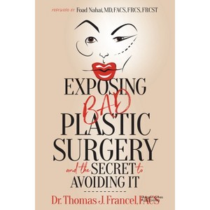 Exposing Bad Plastic Surgery - by  Thomas J Francel (Paperback) - 1 of 1