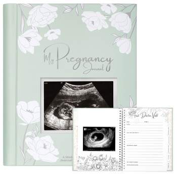 KeaBabies Blossom Pregnancy Journal, 80 Pages Hardcover Pregnancy Book for First Time Moms, Baby Memory Book