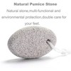 2-Pack Natural Foot Pumice Stone for Feet, Borogo  Lava Pedicure Tools Hard Skin Callus Remover for Feet and Hands - 4 of 4