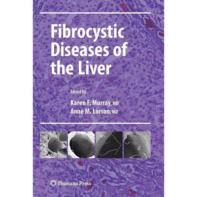 Fibrocystic Diseases of the Liver - (Clinical Gastroenterology) by  Karen F Murray & Anne M Larson (Paperback)