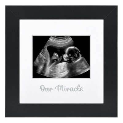 Americanflat Sonogram Picture Frame - 7x7 Ultrasound Frame for 3x4 Sonograms with Interchangeable Mats -- Photo Frame for Tabletop and Wall - Black
