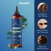Botanic Hearth 100% Pure Rosemary Hair Oil For Hair Growth Infused With Biotin - 2 of 4