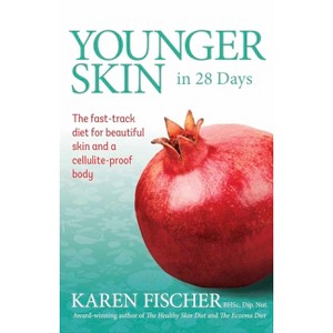Younger Skin in 28 Days - by  Karen Fischer (Paperback) - 1 of 1