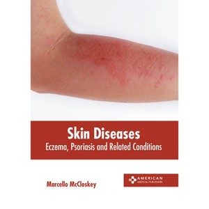 Skin Diseases: Eczema, Psoriasis and Related Conditions - by  Marcello McCloskey (Hardcover) - 1 of 1