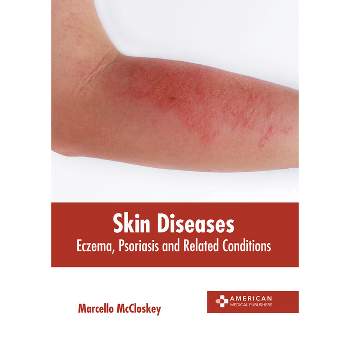 Skin Diseases: Eczema, Psoriasis and Related Conditions - by  Marcello McCloskey (Hardcover)