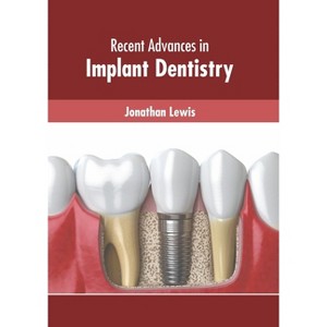 Recent Advances in Implant Dentistry - by  Jonathan Lewis (Hardcover) - 1 of 1