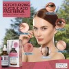 Advanced Clinicals 10% Glycolic Acid Peel Face Serum with Salicylic Acid for Pores and Fine Lines. 1.75 Fl Oz - 4 of 4