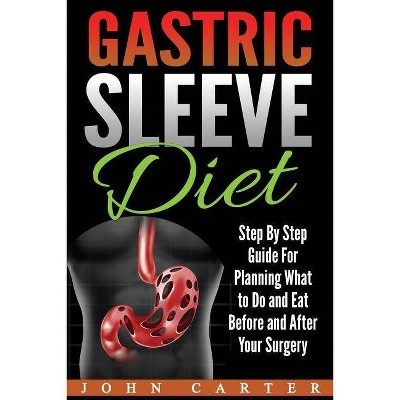 Gastric Sleeve Diet - by  John Carter (Paperback)