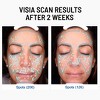 Advanced Face Exfoliator - 4 of 4