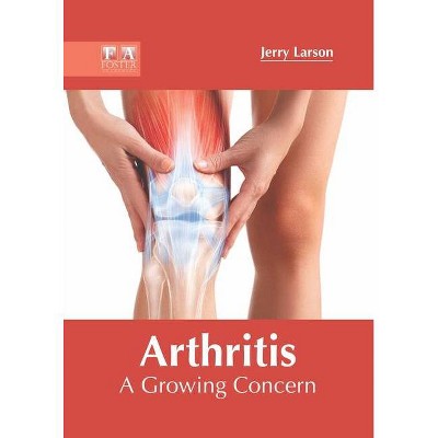 Arthritis: A Growing Concern - by  Jerry Larson (Hardcover)