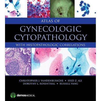 Atlas of Gynecologic Cytopathology - by  Christopher J Vandenbussche & Syed Z Ali & Dorothy L Rosenthal & Russell Vang (Hardcover)