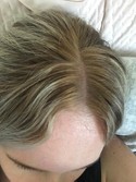 Sun Bum Blonde Formula Hair Lightener 4 Fl Oz Target