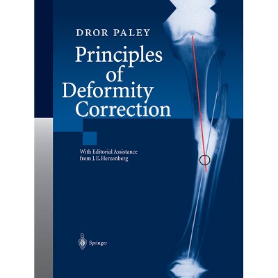 Principles of Deformity Correction - by  Dror Paley (Paperback)
