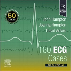 160 ECG Cases - 6th Edition by  John Hampton & Joanna Hampton & David Adlam (Paperback) - 1 of 1