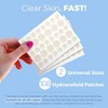 MEDca Hydrocolloid Acne Patches for Face – 108-Count Pimple Spot Bandages in 2 Sizes for Acne, Zits & Blackheads - 2 of 4