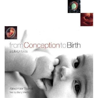  From Conception to Birth - by  Alexander Tsiaras (Hardcover) 