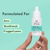 Rael Miracle Clear Complete Acne Treatment Face Serum - 1oz - 4 of 4
