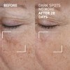 Dr. Brandt Bright This Way Dark Spots No More - Reduces Number, Intensity & Size of Pigmented Spots - 0.5 fl oz - 2 of 4