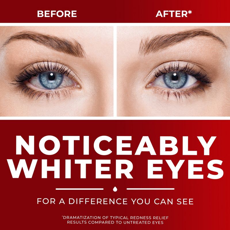 Clear Eyes Maximum Strength Eye Drops for Redness Relief, Dryness, Burning, &#38; Irritation - 0.5 fl oz, 5 of 8