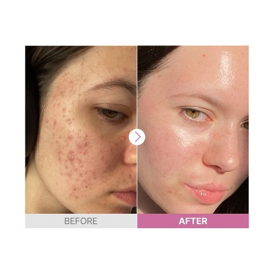 Immagine del prodotto 5