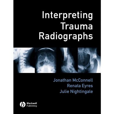 Interpreting Trauma Radiographs - by  Jonathan McConnell & Renata Eyres & Julie Nightingale (Paperback)