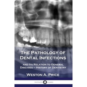The Pathology of Dental Infections - by  Weston a Price (Paperback) - 1 of 1