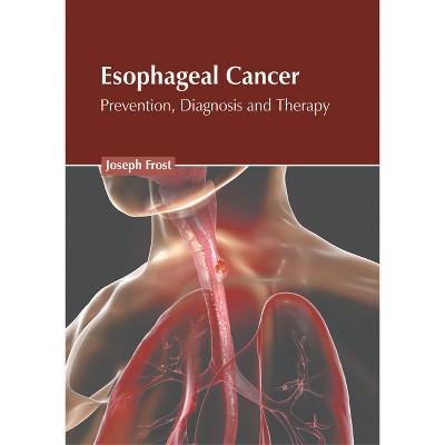 Esophageal Cancer: Prevention, Diagnosis and Therapy - by  Joseph Frost (Hardcover)