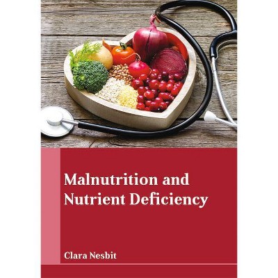 Malnutrition and Nutrient Deficiency - by  Clara Nesbit (Hardcover)