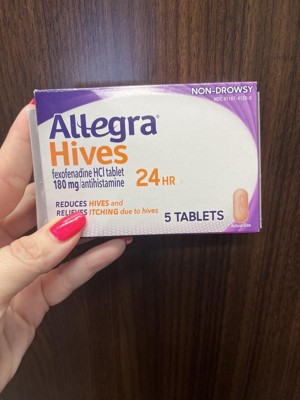 Can Fexo 180 Cause Hives? : Fexofenadine tablets (Telfast, Allegra ...