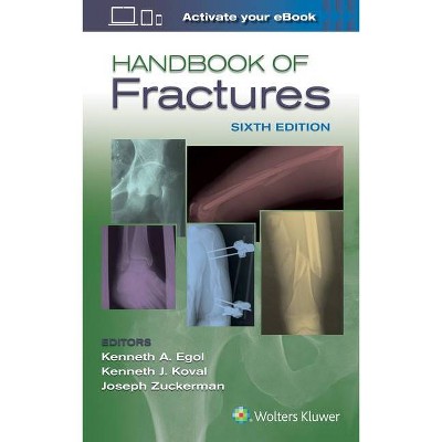 Handbook of Fractures - 6th Edition by  Kenneth Egol (Paperback)