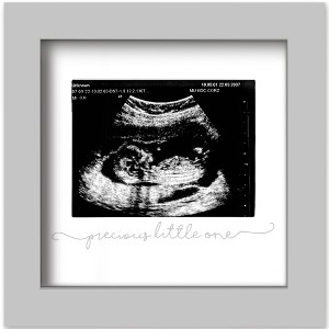 KeaBabies Solo Baby Sonogram Picture Frame, Modern Ultrasound Picture Frames, Pregnancy Announcements Sonogram Frame - 1 of 4