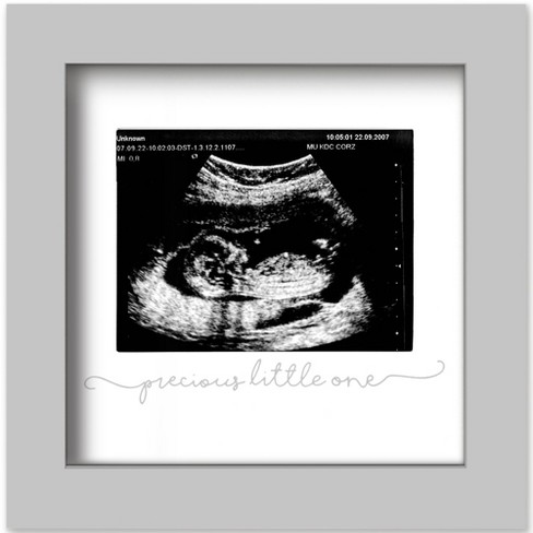 KeaBabies Solo Baby Sonogram Picture Frame, Modern Ultrasound Picture Frames, Pregnancy Announcements Sonogram Frame - image 1 of 4