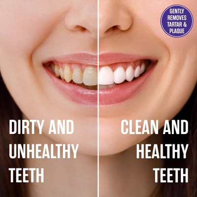 SprinJene Natural Fluoride-Free Sensitive Relief Toothpaste Sodium Lauryl Sulfate-Free - 3.5oz/2ct