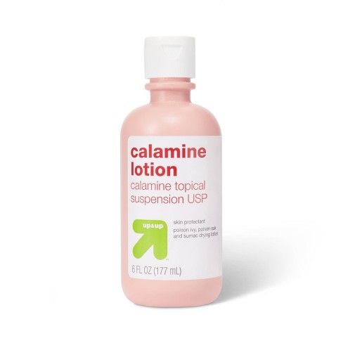 chicken pox calamine lotion