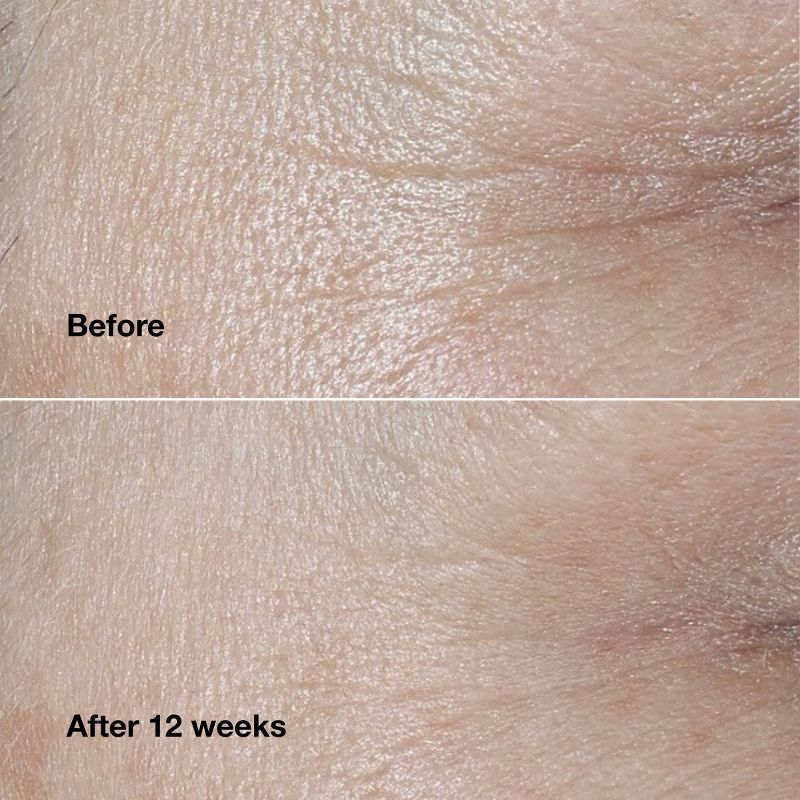 Clinique Smart Clinical Repair Wrinkle Correcting Cream - 1.7oz - Ulta Beauty, 5 of 8
