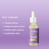 SheaMoisture Radiance 4-in-1 Acne Face - 1 fl oz - 4 of 4